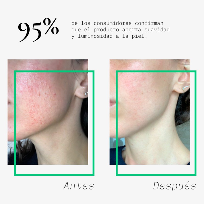 Beauté mediterranea Acne Free Pack con Hechy Complex y Ácido Salicílico Envío internacional gratuito