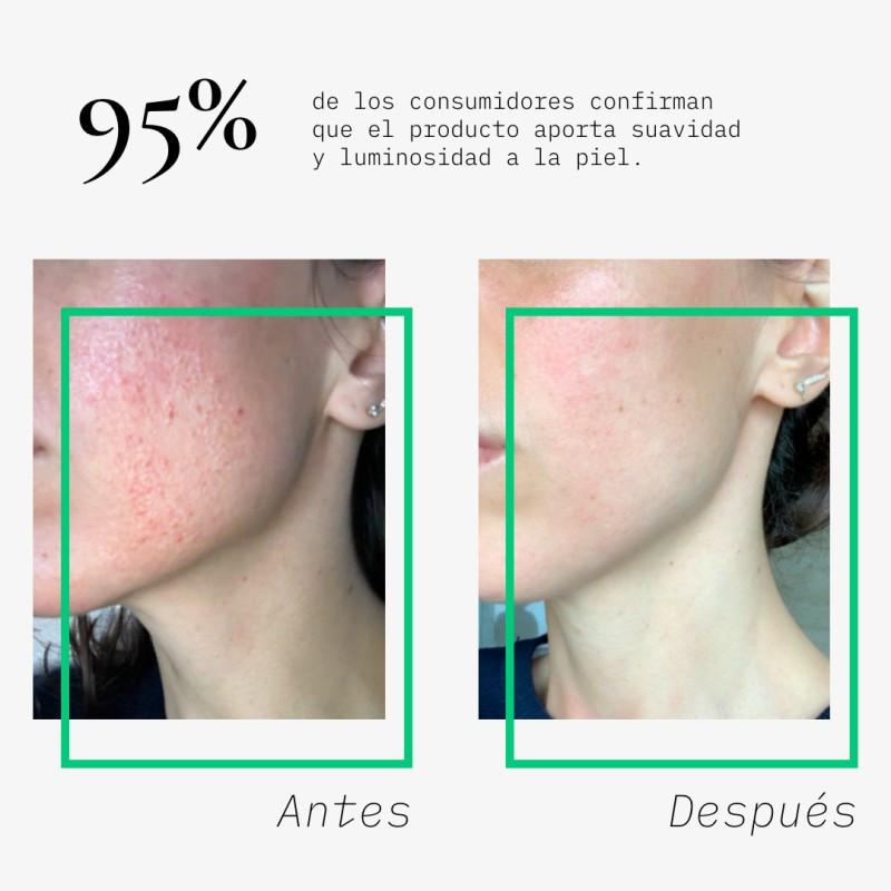 Beauté mediterranea PACK BYE SENSITIVE SKIN CON ACIDO HIALURONICO Y NIANCINAMIDA Precio ultrabajo