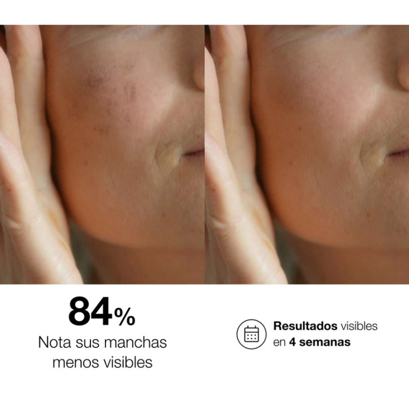 Bella Aurora Tratamiento Intensivo para Todo Tipo de Piel. bio10 forte + Noche En oferta