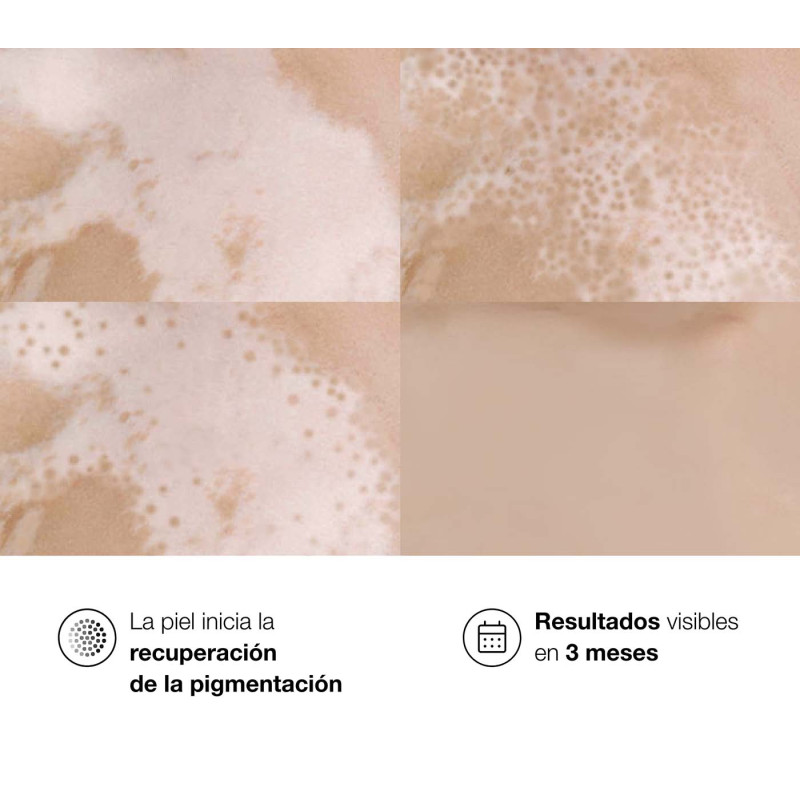Bella Aurora Repigment12® Crema Reguladora de la pigmentación cutánea Ofertas especiales