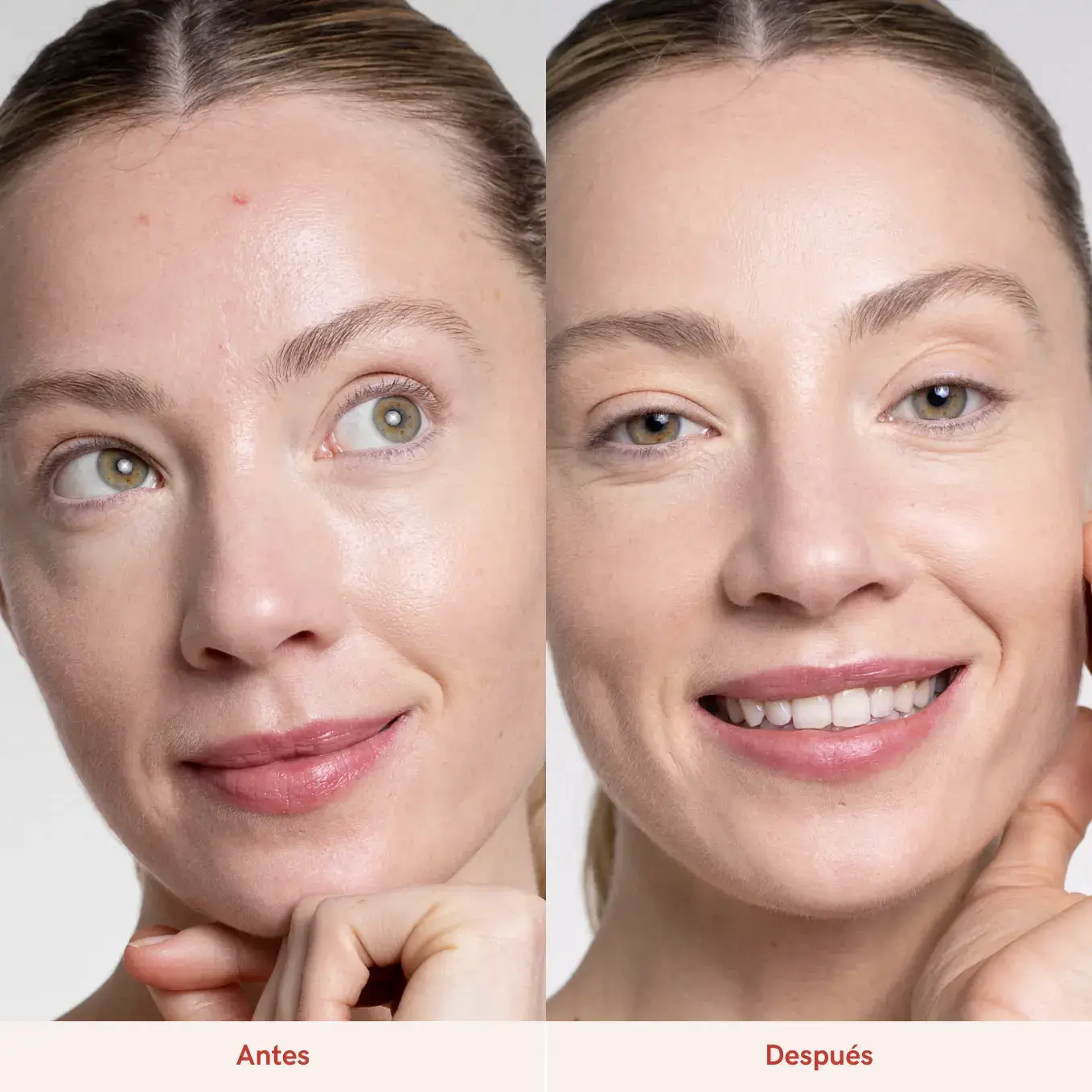 lullage Skin Perfector Drops Serum Bifásico Antimanchas y Granos | Lullage COMPRAR AHORA
