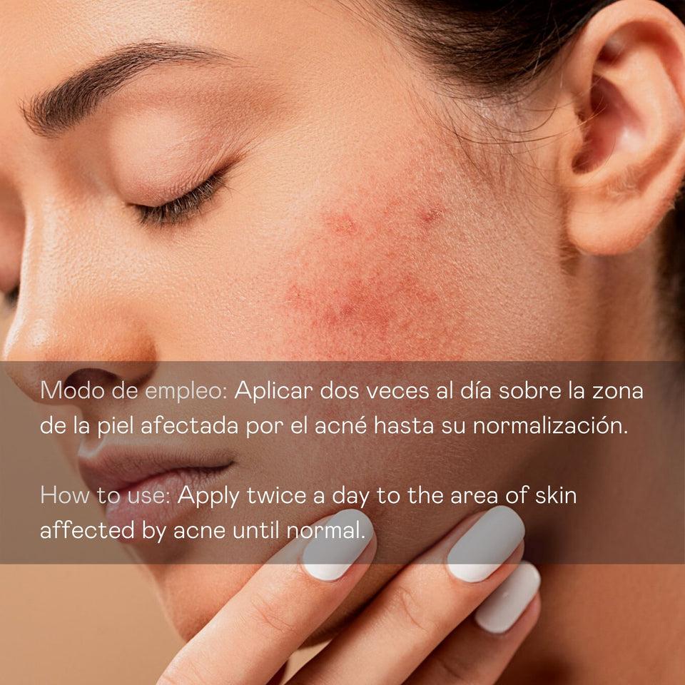 valquer laboratorios Sérum facial antiimperfecciones directo - 30 ml Oferta especial de fábrica