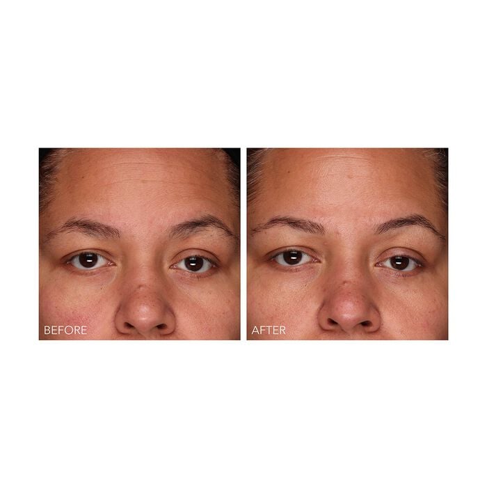 Dr. Dennis Gross DermInfusions - Gel Regeneración Rápida En oferta