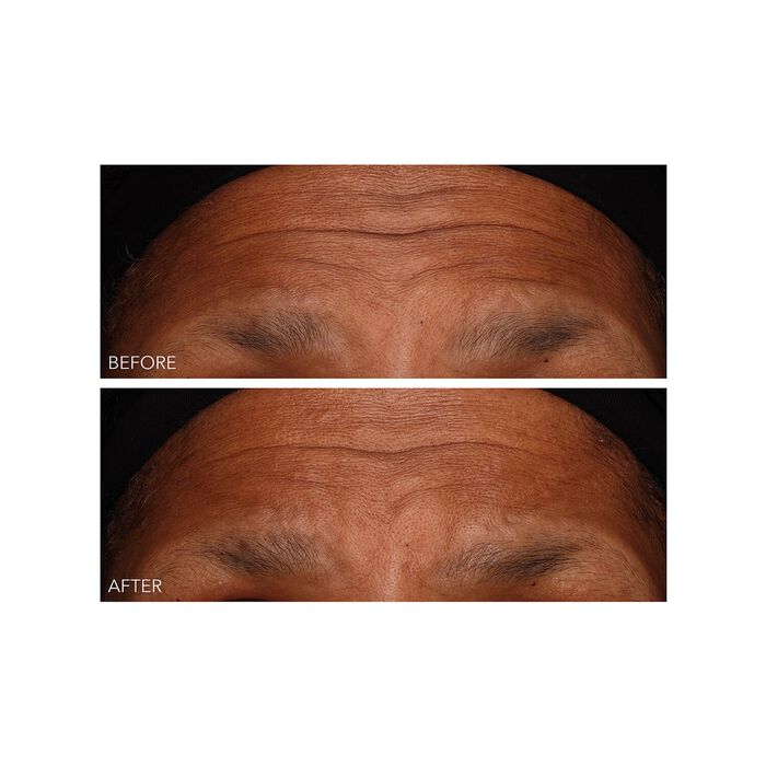 Dr. Dennis Gross DermInfusions - Gel Regeneración Rápida En oferta