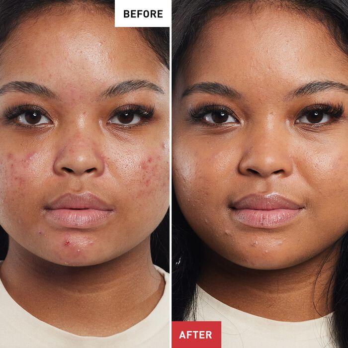 Erborian Super BB Au Ginseng - BB Cream Anti-Imperfecciones Ofertas de temporada